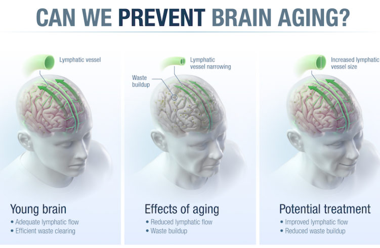 By fixing aging vessels surrounding the brain, we may be able to prevent Alzheimer's disease, age-related memory loss and other neurological problems.
