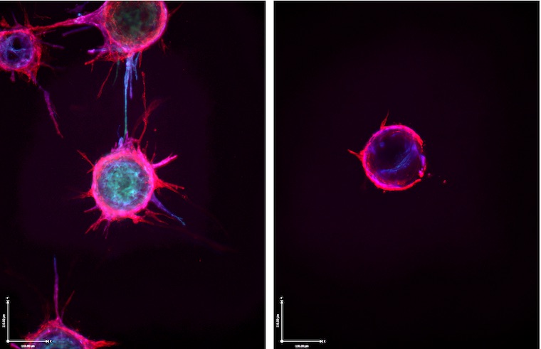 Untreated blood vessel sprouts (left), compared with blood vessel sprouts following treatment with microRNA.