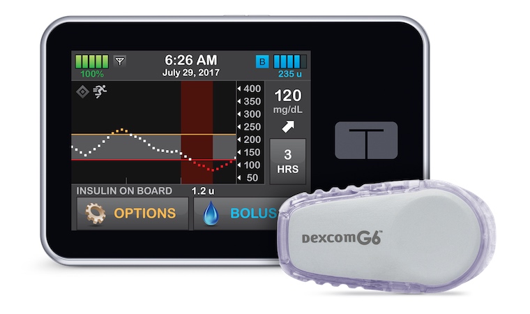 Artificial pancreas system better controls blood glucose levels than current technology