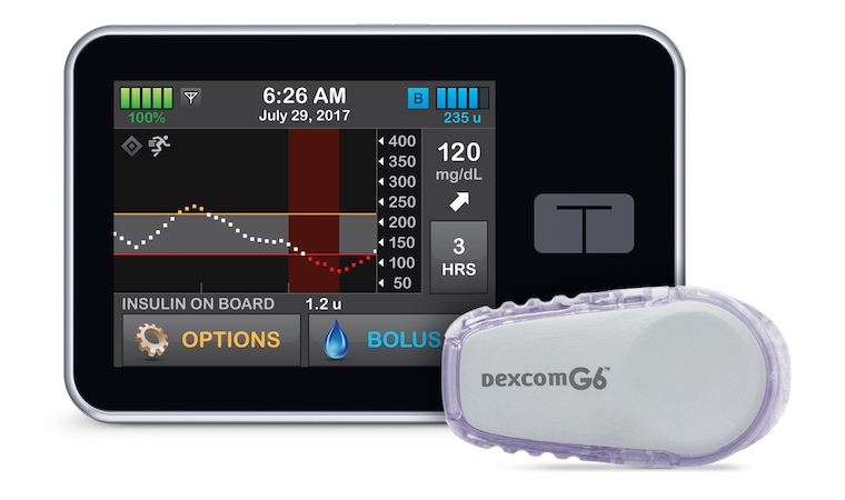 Artificial pancreas development