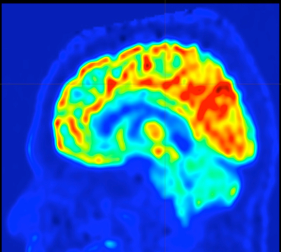 A colorful brain map created using a new approach developed at UVA.