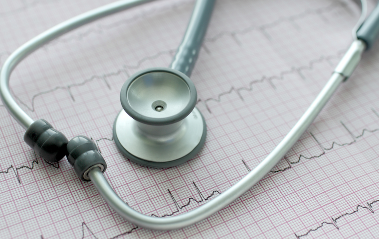 Findings to Help Prevent, Treat Dangerous Atrial Fibrillation