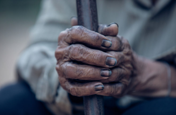 A coal miner's hands, darkened with coal dust.