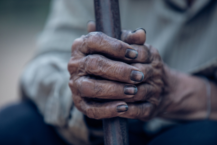 A coal miner's hands, darkened with coal dust.