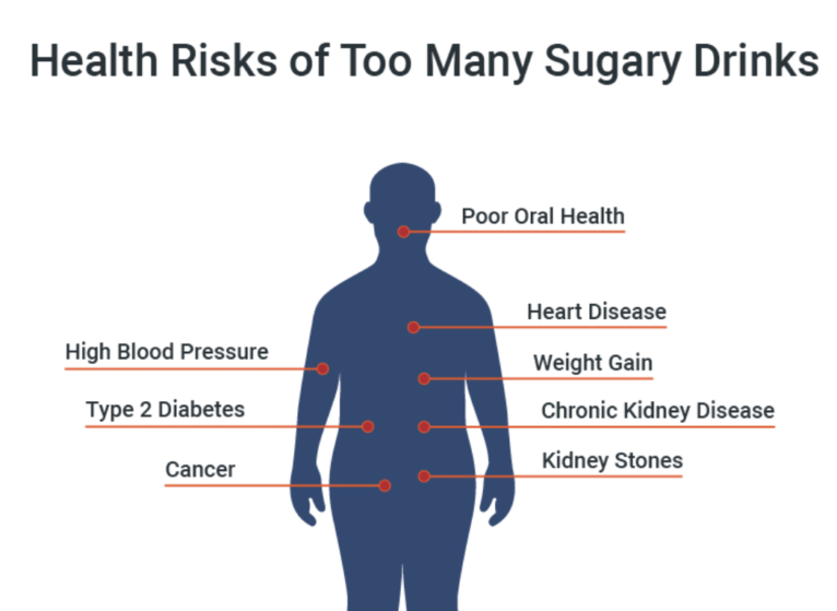 A figure illustrates the health risks of too many sugary drinks, including heart disease, poor bone health and high blood pressure.