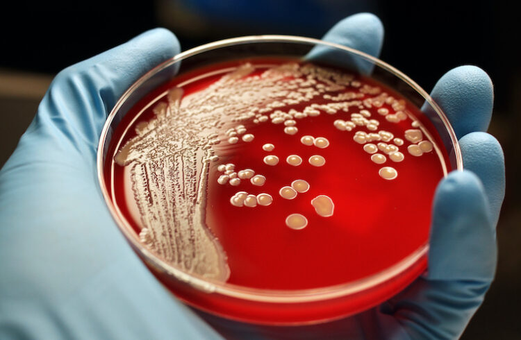 Staph colonies in a Petri dish