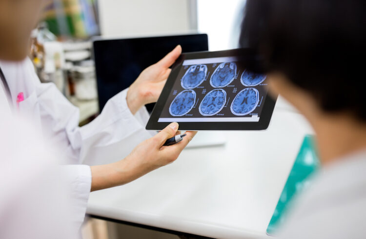 Doctors look at brain scans on a tablet