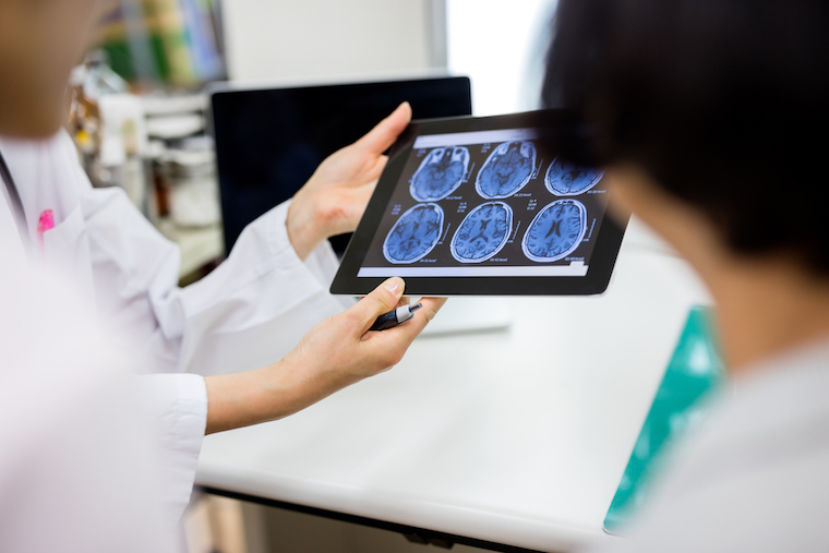 Doctors look at brain scans on a tablet