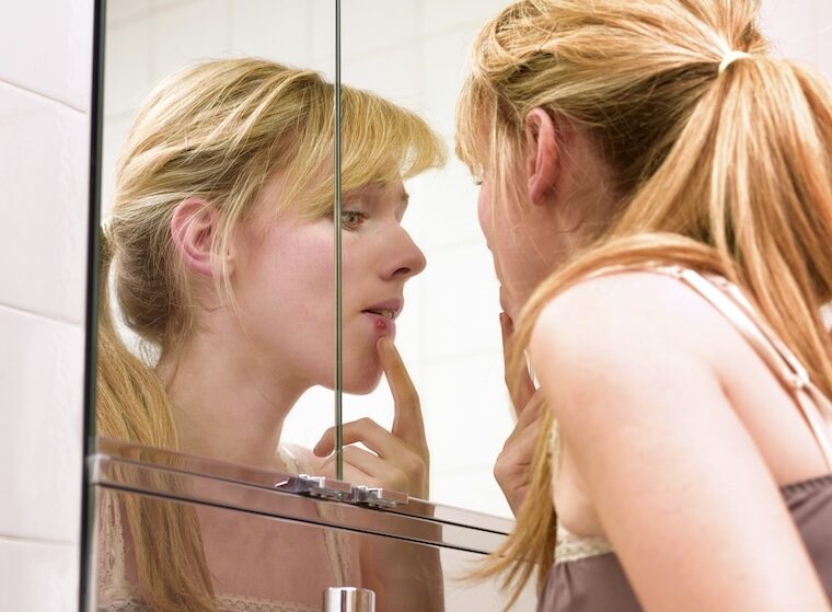 Woman inspecting cold sore in mirror